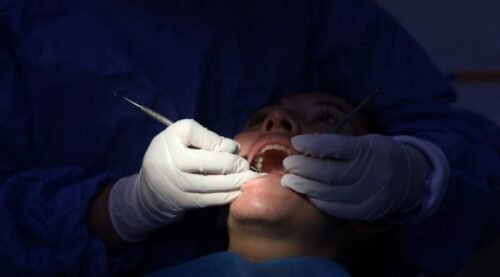 LIMPIEZA DENTAL / RESINA DENTAL