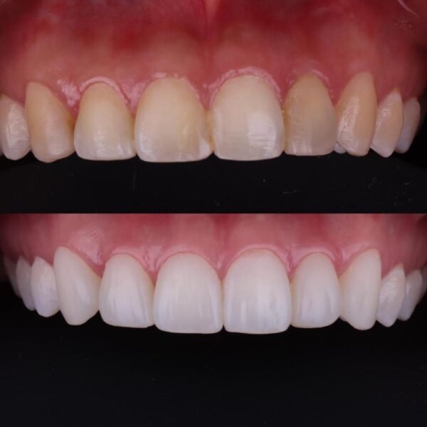 84d9c11f-f655-4c01-af56-414e2a06d26e CARILLAS DENTALES