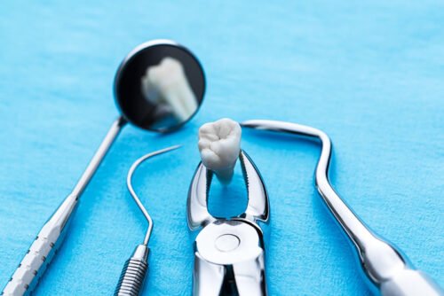 EXTRACCION DENTAL Y CIRUGIA DENTAL